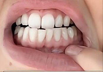 Na 30 minuten GlowyTeeth